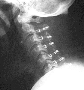 neck X-ray